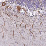 Atlas Antibodies Anti-C20orf194 Antibody