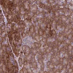 Atlas Antibodies Anti-C20orf27 Antibody