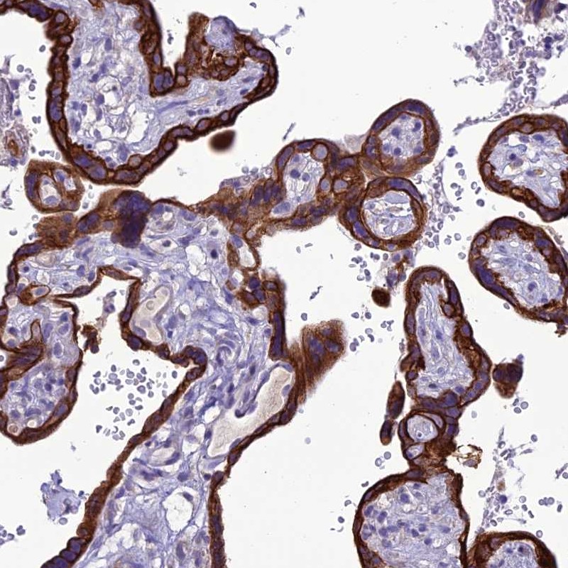 Atlas Antibodies Anti-C20orf202 Antibody