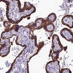 Atlas Antibodies Anti-C20orf202 Antibody