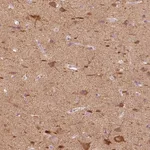 Atlas Antibodies Anti-C20orf194 Antibody