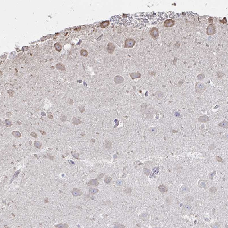 Atlas Antibodies Anti-C20orf24 Antibody