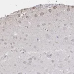 Atlas Antibodies Anti-C20orf24 Antibody