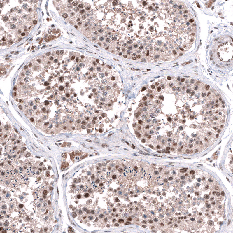 Atlas Antibodies Anti-C20orf196 Antibody