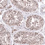 Atlas Antibodies Anti-C20orf196 Antibody