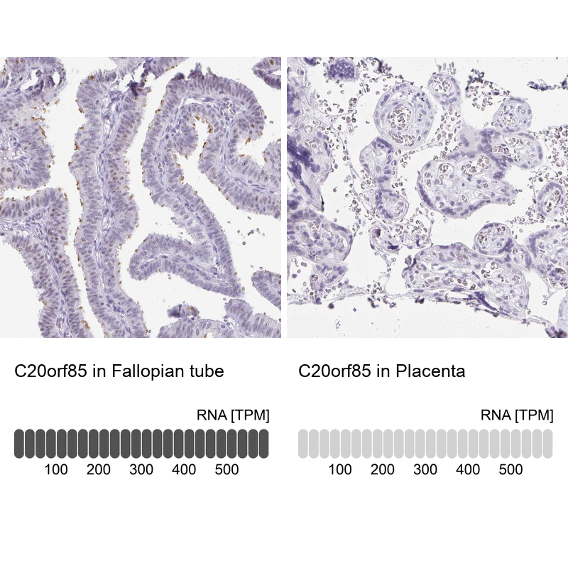 Atlas Antibodies Anti-C20orf85 Antibody