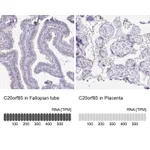 Atlas Antibodies Anti-C20orf85 Antibody