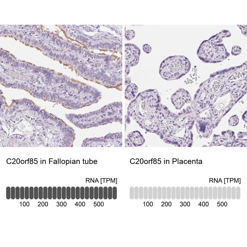 Atlas Antibodies Anti-C20orf85 Antibody