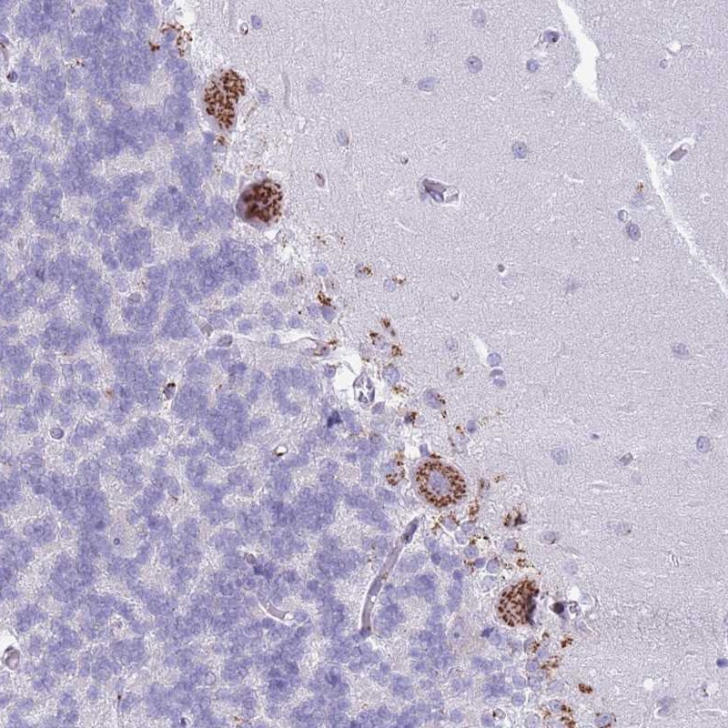 Atlas Antibodies Anti-C20orf96 Antibody