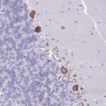 Atlas Antibodies Anti-C20orf96 Antibody