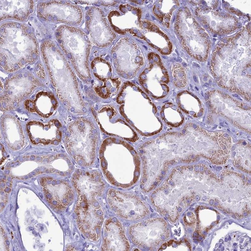 Atlas Antibodies Anti-C21orf140 Antibody