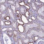 Atlas Antibodies Anti-C21orf140 Antibody