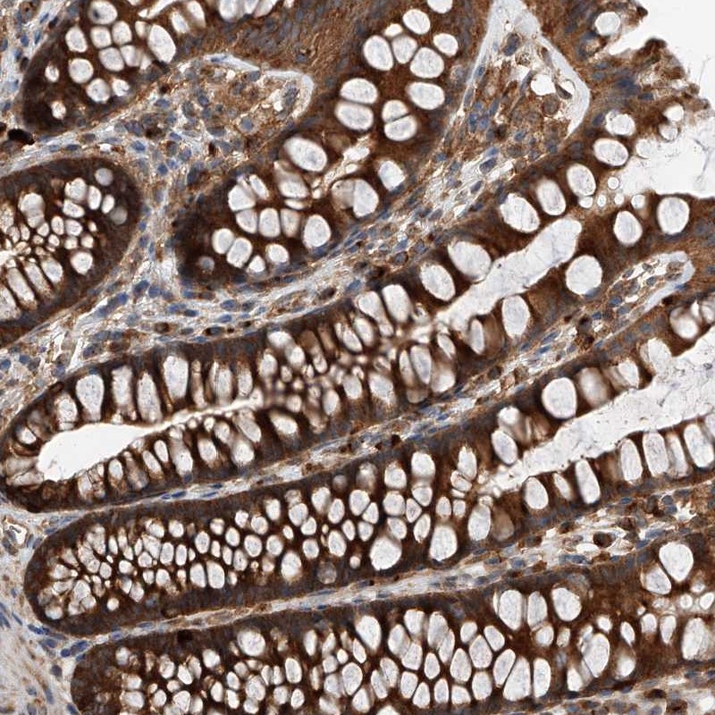Atlas Antibodies Anti-C21orf2 Antibody