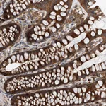 Atlas Antibodies Anti-C21orf2 Antibody