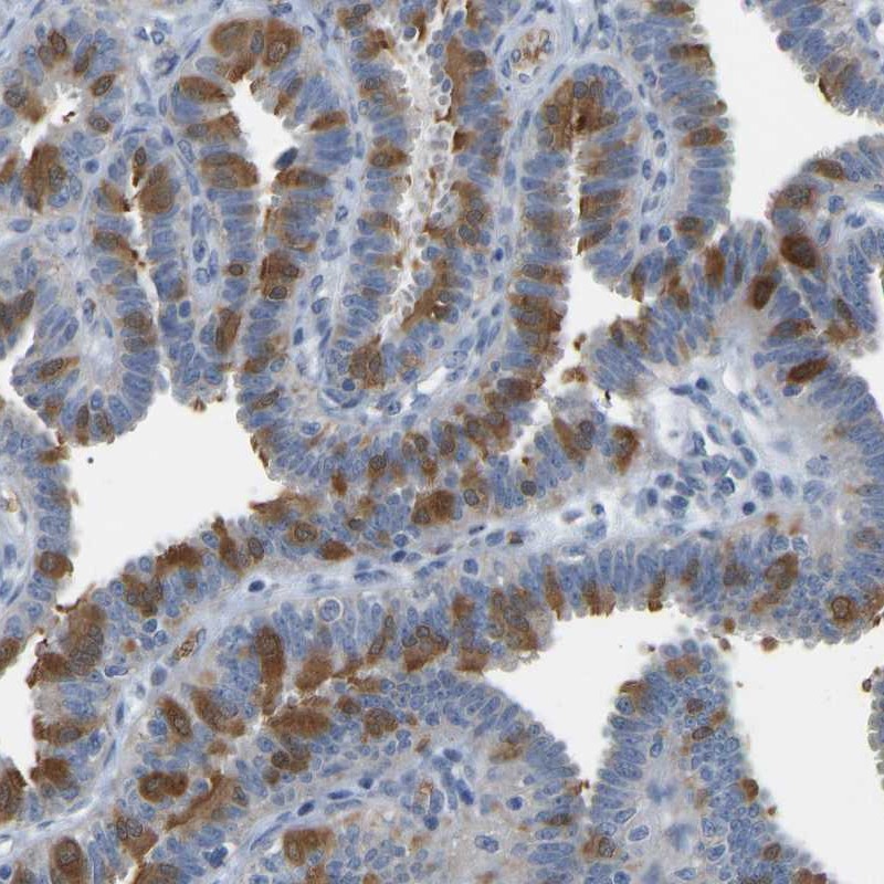 Atlas Antibodies Anti-C21orf59 Antibody