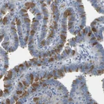 Atlas Antibodies Anti-C21orf59 Antibody