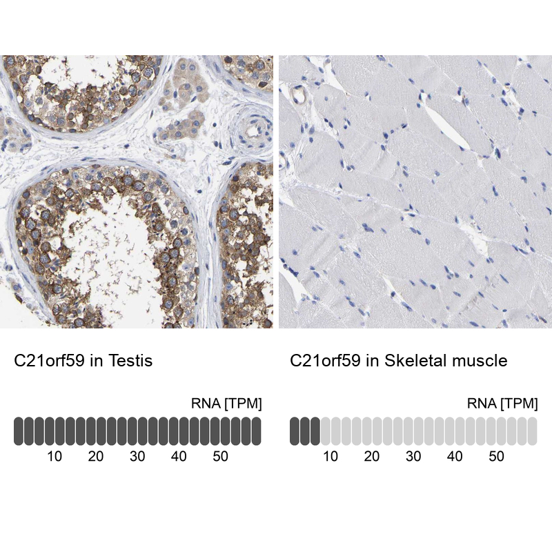 Atlas Antibodies Anti-C21orf59 Antibody