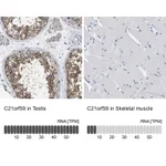 Atlas Antibodies Anti-C21orf59 Antibody