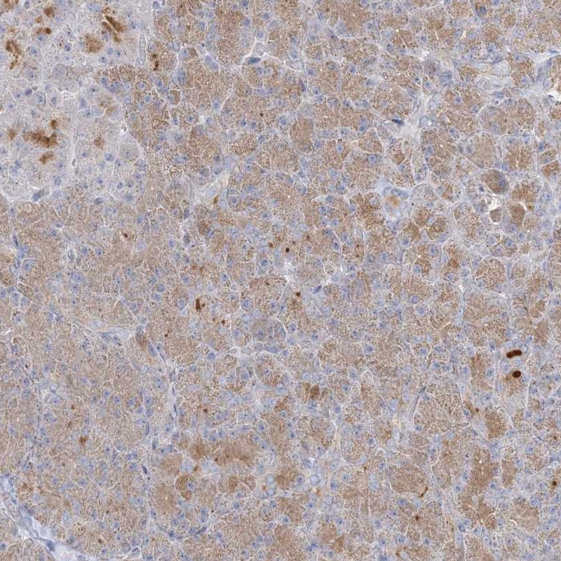 Atlas Antibodies Anti-C21orf58 Antibody