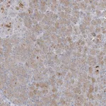 Atlas Antibodies Anti-C21orf58 Antibody
