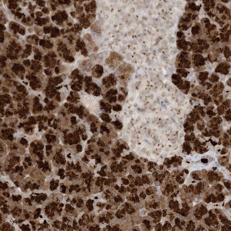 Atlas Antibodies Anti-C21orf58 Antibody