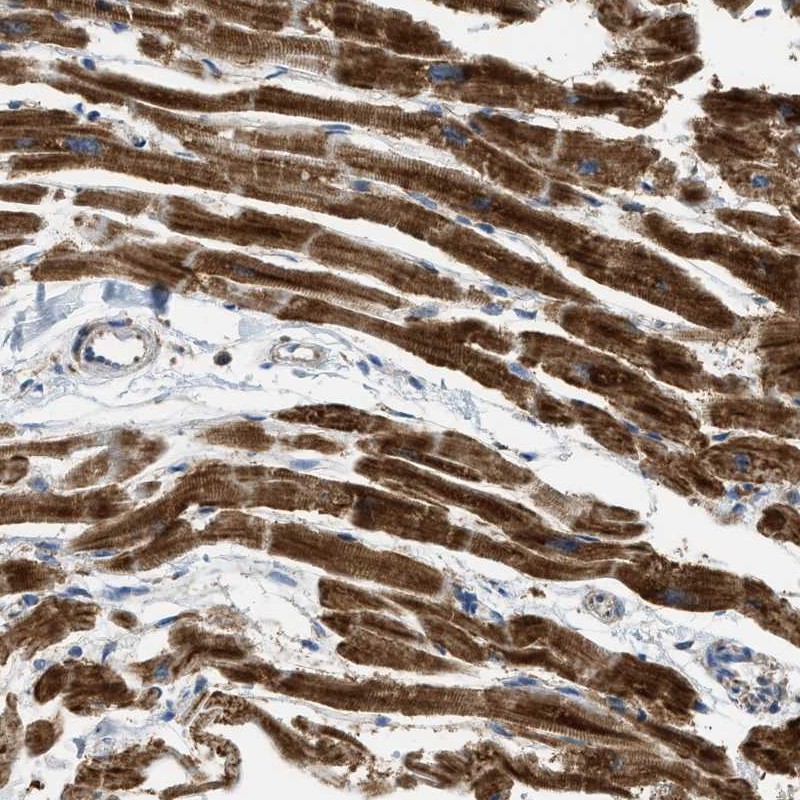 Atlas Antibodies Anti-C21orf33 Antibody
