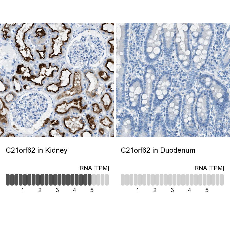 Atlas Antibodies Anti-C21orf62 Antibody