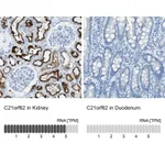 Atlas Antibodies Anti-C21orf62 Antibody