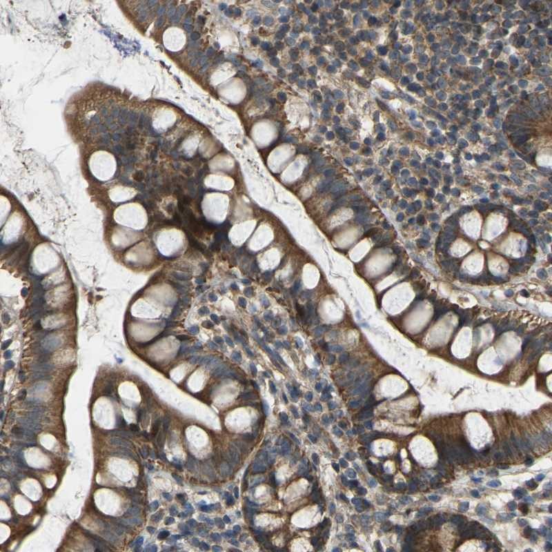 Atlas Antibodies Anti-C21orf91 Antibody