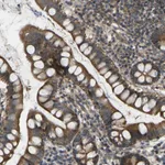 Atlas Antibodies Anti-C21orf91 Antibody