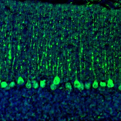 Atlas Antibodies Anti-C21orf59 Antibody