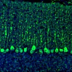 Atlas Antibodies Anti-C21orf59 Antibody