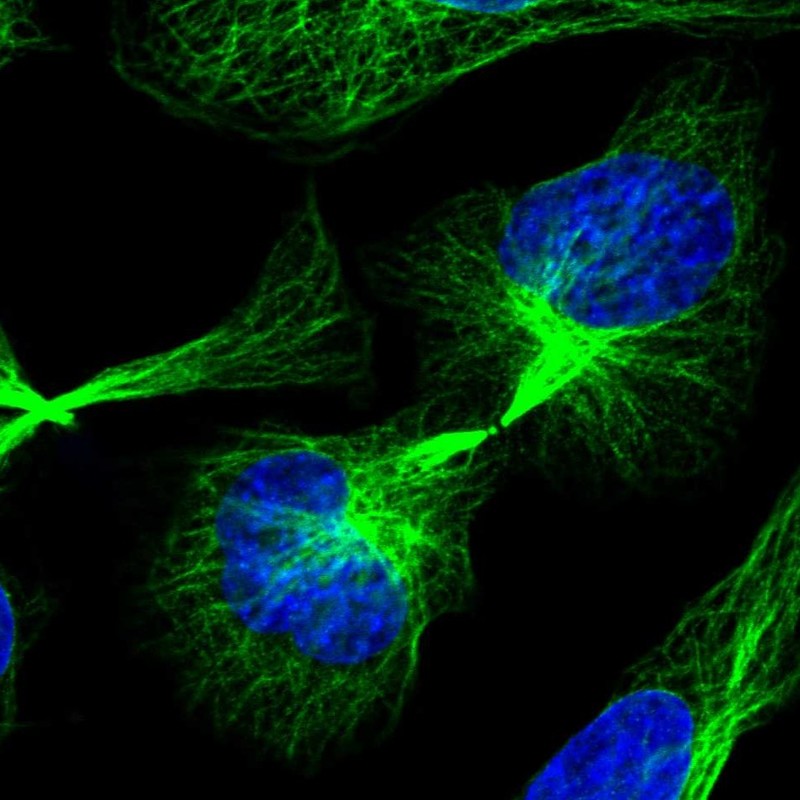 Atlas Antibodies Anti-C21orf91 Antibody