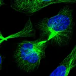 Atlas Antibodies Anti-C21orf91 Antibody