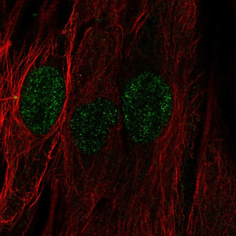 Atlas Antibodies Anti-C22orf23 Antibody