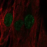 Atlas Antibodies Anti-C22orf23 Antibody