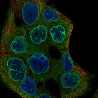 Atlas Antibodies Anti-C22orf31 Antibody
