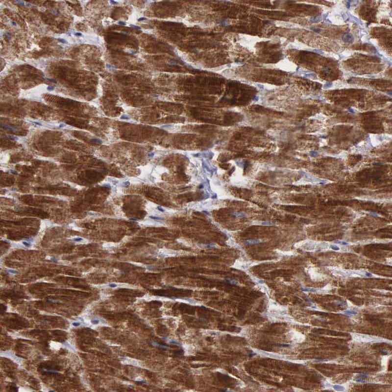 Atlas Antibodies Anti-C22orf29 Antibody