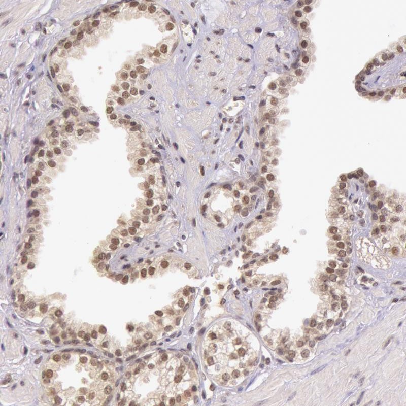 Atlas Antibodies Anti-C22orf29 Antibody