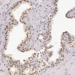 Atlas Antibodies Anti-C22orf29 Antibody