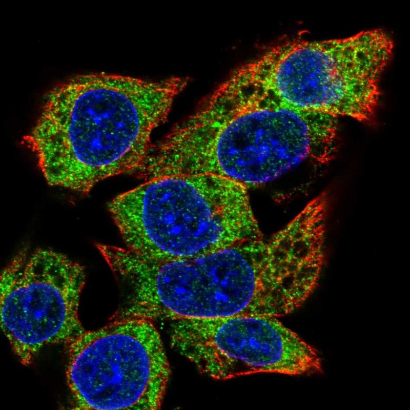 Atlas Antibodies Anti-C22orf39 Antibody