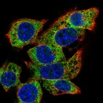 Atlas Antibodies Anti-C22orf39 Antibody