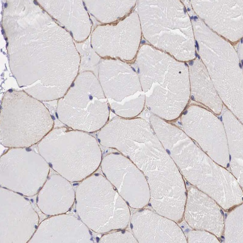 Atlas Antibodies Anti-C22orf31 Antibody