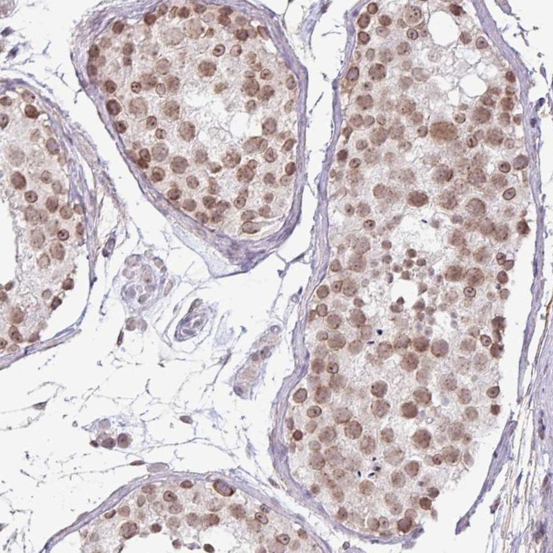 Atlas Antibodies Anti-C22orf46 Antibody