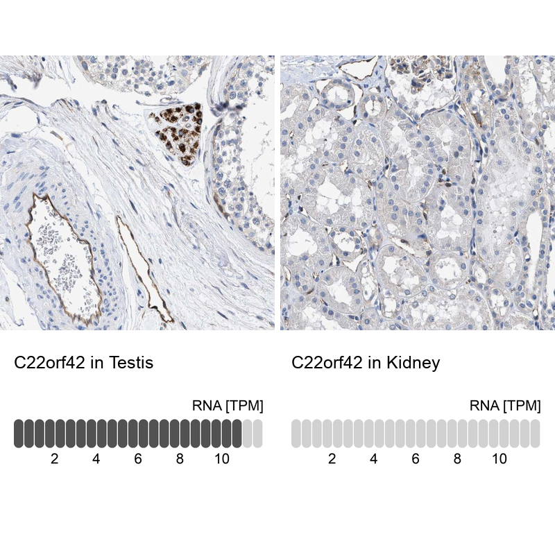 Atlas Antibodies Anti-C22orf42 Antibody