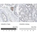 Atlas Antibodies Anti-C22orf42 Antibody