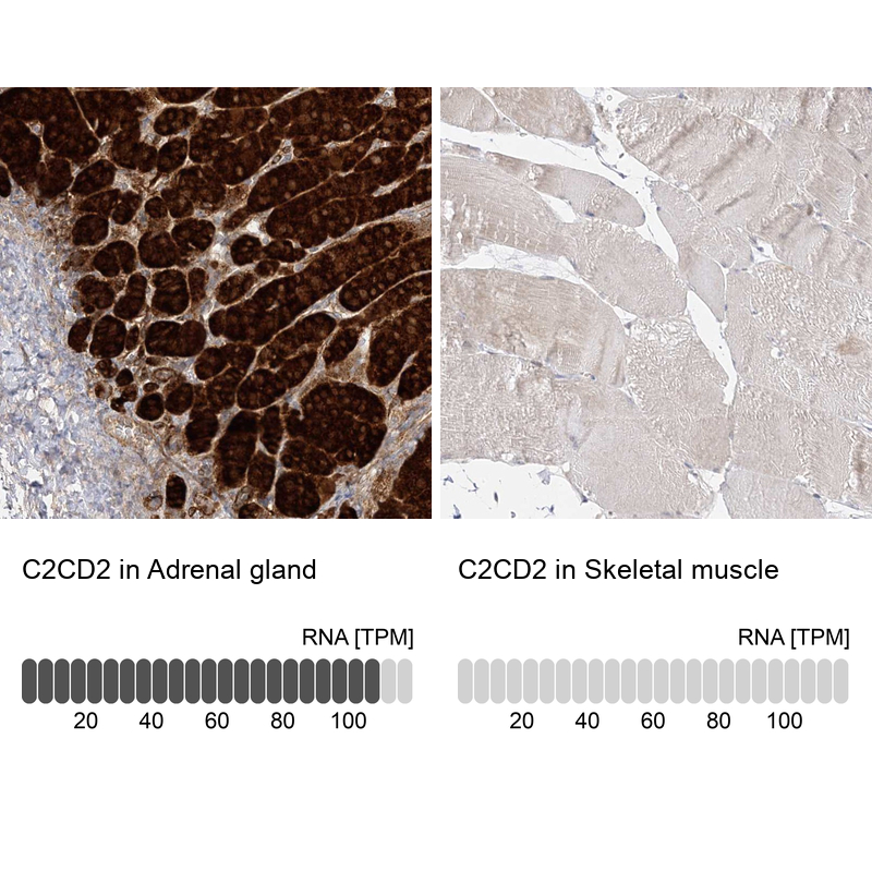 Atlas Antibodies Anti-C2CD2 Antibody