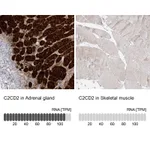 Atlas Antibodies Anti-C2CD2 Antibody