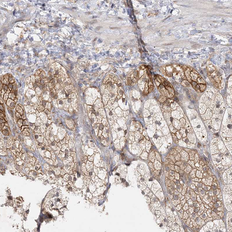 Atlas Antibodies Anti-C2CD2 Antibody