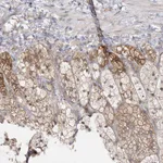 Atlas Antibodies Anti-C2CD2 Antibody